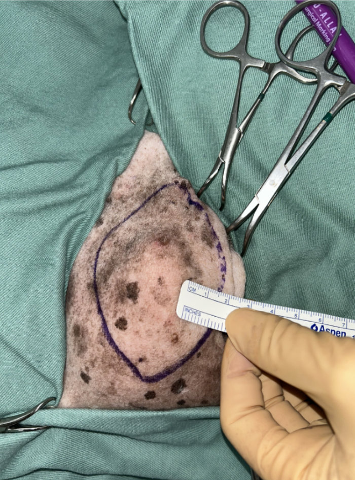 犬の皮下肥満細胞腫・写真２